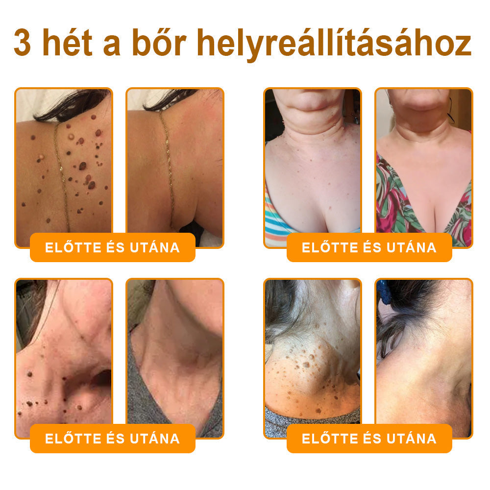 💕💕Ajánlott a Semmelweis Kórház   által · BENU hivatalos üzlet ✨✨   APKAPK® méhméreges   bőrmegújító krém