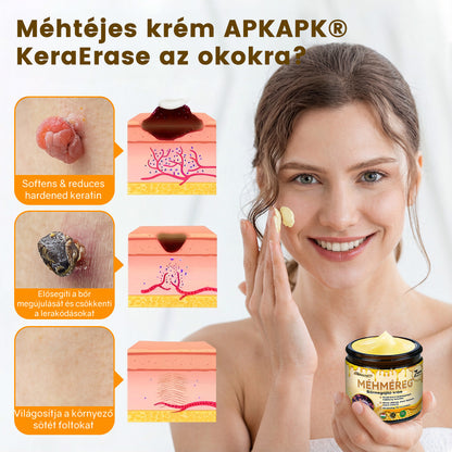 💕💕Ajánlott a Semmelweis Kórház   által · BENU hivatalos üzlet ✨✨   APKAPK® méhméreges   bőrmegújító krém