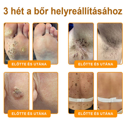 💕💕Ajánlott a Semmelweis Kórház   által · BENU hivatalos üzlet ✨✨   APKAPK® méhméreges   bőrmegújító krém