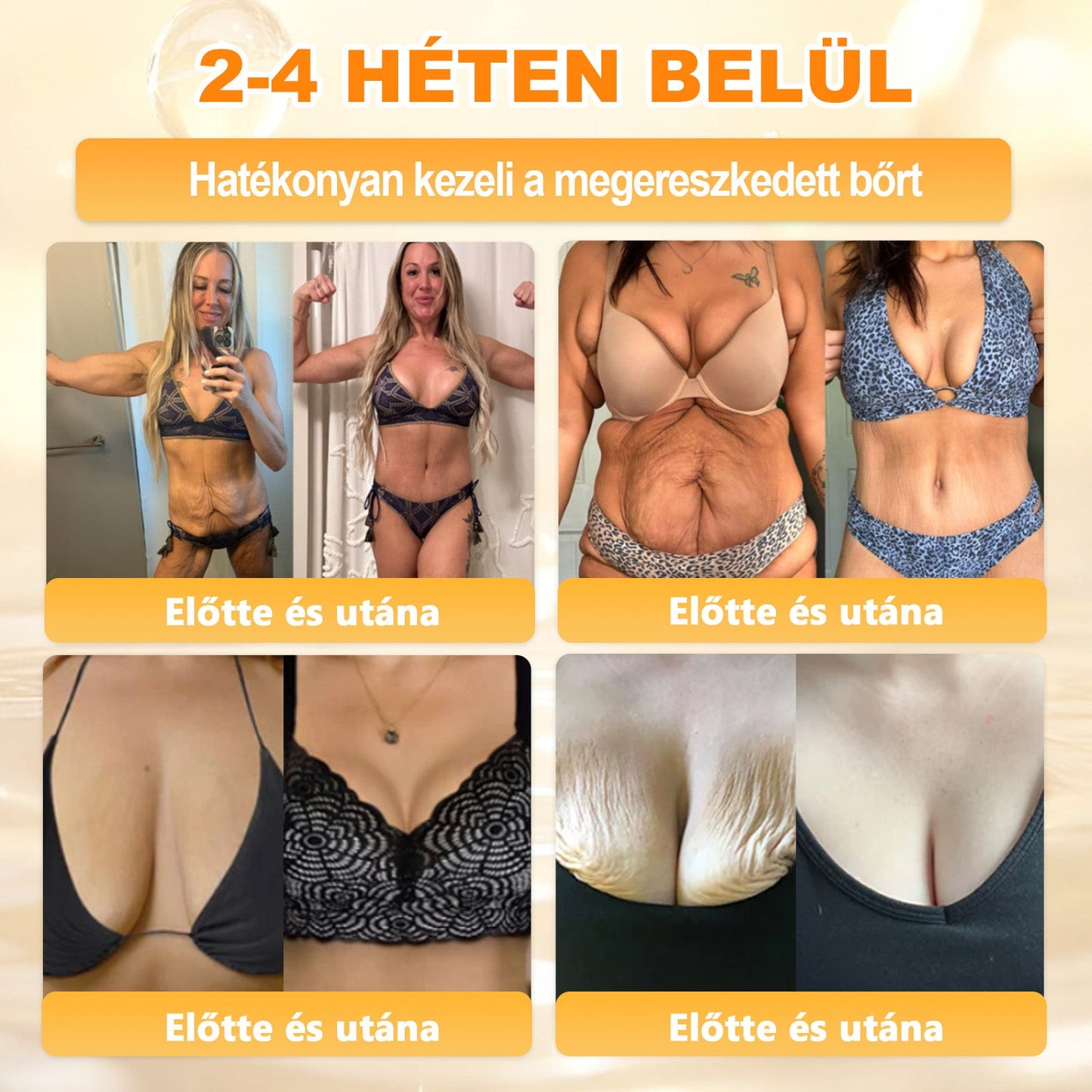 💕💕Ajánlott a Semmelweis Kórház   által · BENU hivatalos üzlet ✨✨   APKAPK® méhméreges   bőrmegújító krém