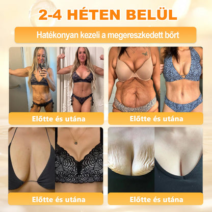 💕💕Ajánlott a Semmelweis Kórház   által · BENU hivatalos üzlet ✨✨   APKAPK® méhméreges   bőrmegújító krém