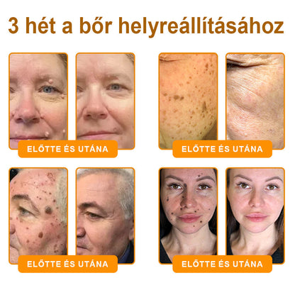 💕💕Ajánlott a Semmelweis Kórház   által · BENU hivatalos üzlet ✨✨   APKAPK® méhméreges   bőrmegújító krém