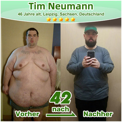 🎁 Nur noch 5 Packungen verfügbar!  🔥 Zusätzliche 30 % Rabatt nur heute!  Jetzt zugreifen, bevor das Angebot endet.