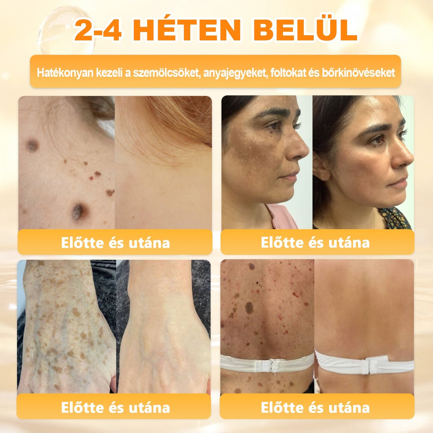 💕💕Ajánlott a Semmelweis Kórház   által · BENU hivatalos üzlet ✨✨   APKAPK® méhméreges   bőrmegújító krém
