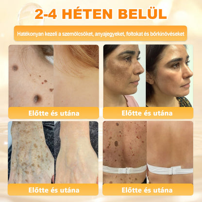 💕💕Ajánlott a Semmelweis Kórház   által · BENU hivatalos üzlet ✨✨   APKAPK® méhméreges   bőrmegújító krém