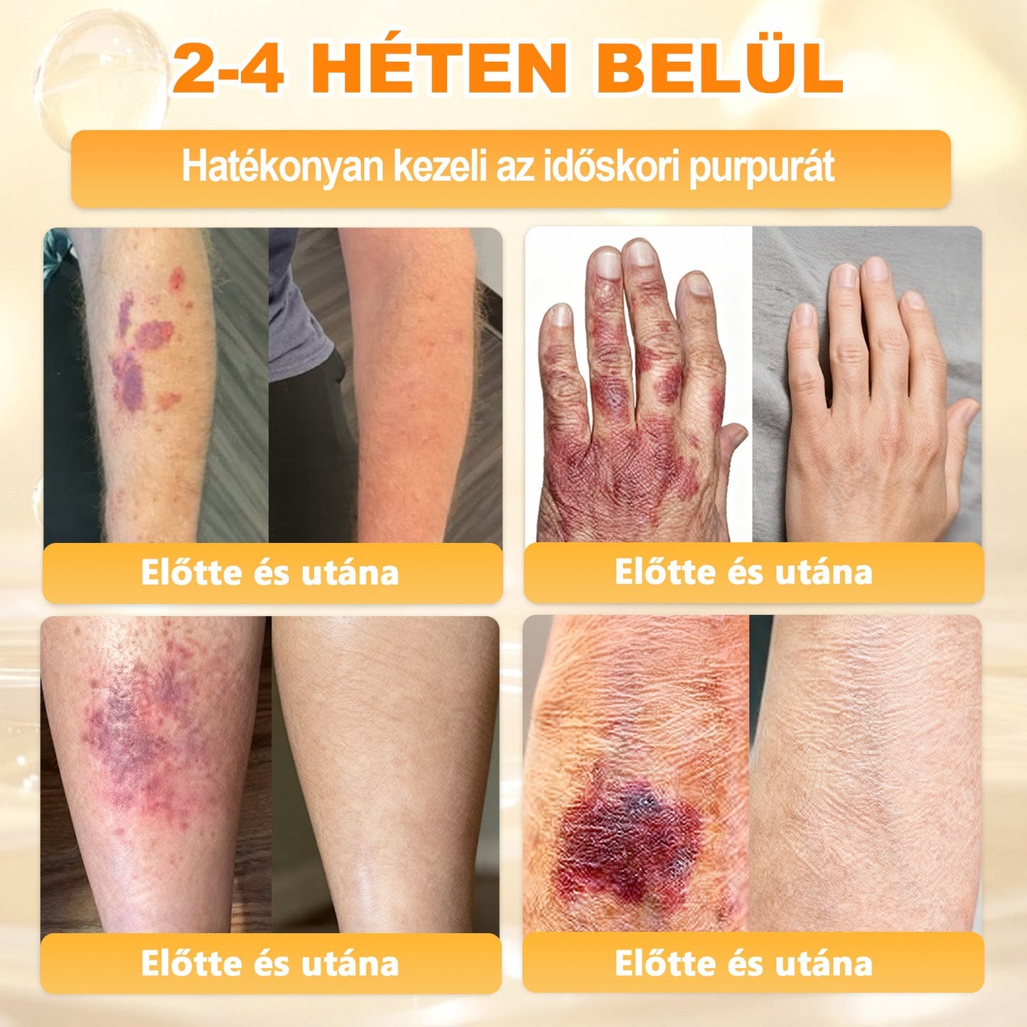 💕💕Ajánlott a Semmelweis Kórház   által · BENU hivatalos üzlet ✨✨   APKAPK® méhméreges   bőrmegújító krém