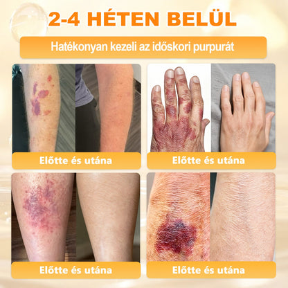 💕💕Ajánlott a Semmelweis Kórház   által · BENU hivatalos üzlet ✨✨   APKAPK® méhméreges   bőrmegújító krém