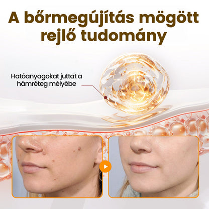 💕💕Ajánlott a Semmelweis Kórház   által · BENU hivatalos üzlet ✨✨   APKAPK® méhméreges   bőrmegújító krém