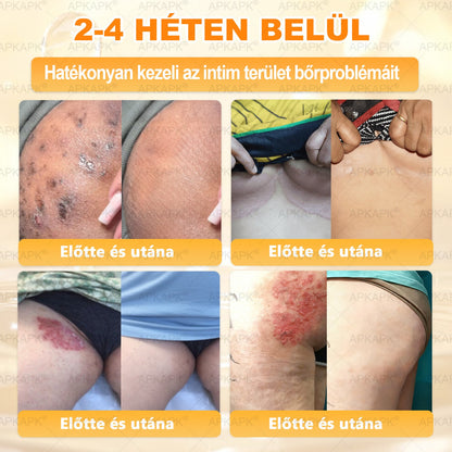💕💕Ajánlott a Semmelweis Kórház   által · BENU hivatalos üzlet ✨✨   APKAPK® méhméreges   bőrmegújító krém