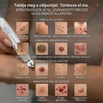 🚢Hivatalos Márkabolt | 🚢🚢 Hiskin® 7 napos Szemölcseltávolító Roll-on Ápoló Folyadék (Fájdalommentes rollerball technológia, hegek nélkül) 🐬