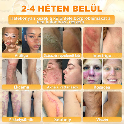 💕💕Ajánlott a Semmelweis Kórház   által · BENU hivatalos üzlet ✨✨   APKAPK® méhméreges   bőrmegújító krém