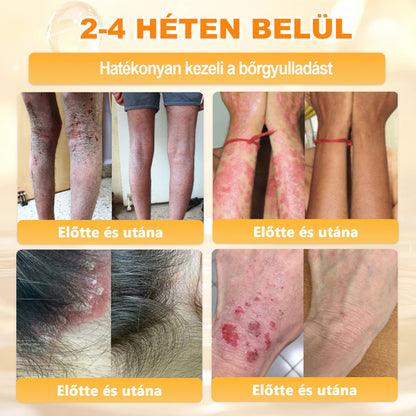 💕💕Ajánlott a Semmelweis Kórház   által · BENU hivatalos üzlet ✨✨   APKAPK® méhméreges   bőrmegújító krém