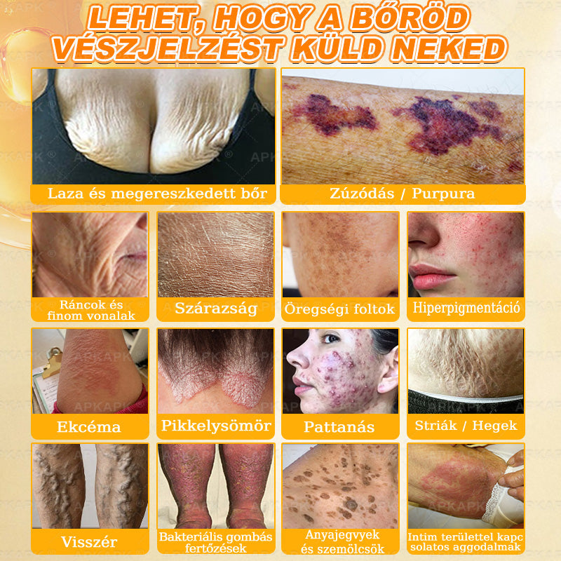 💕💕Ajánlott a Semmelweis Kórház   által · BENU hivatalos üzlet ✨✨   APKAPK® méhméreges   bőrmegújító krém